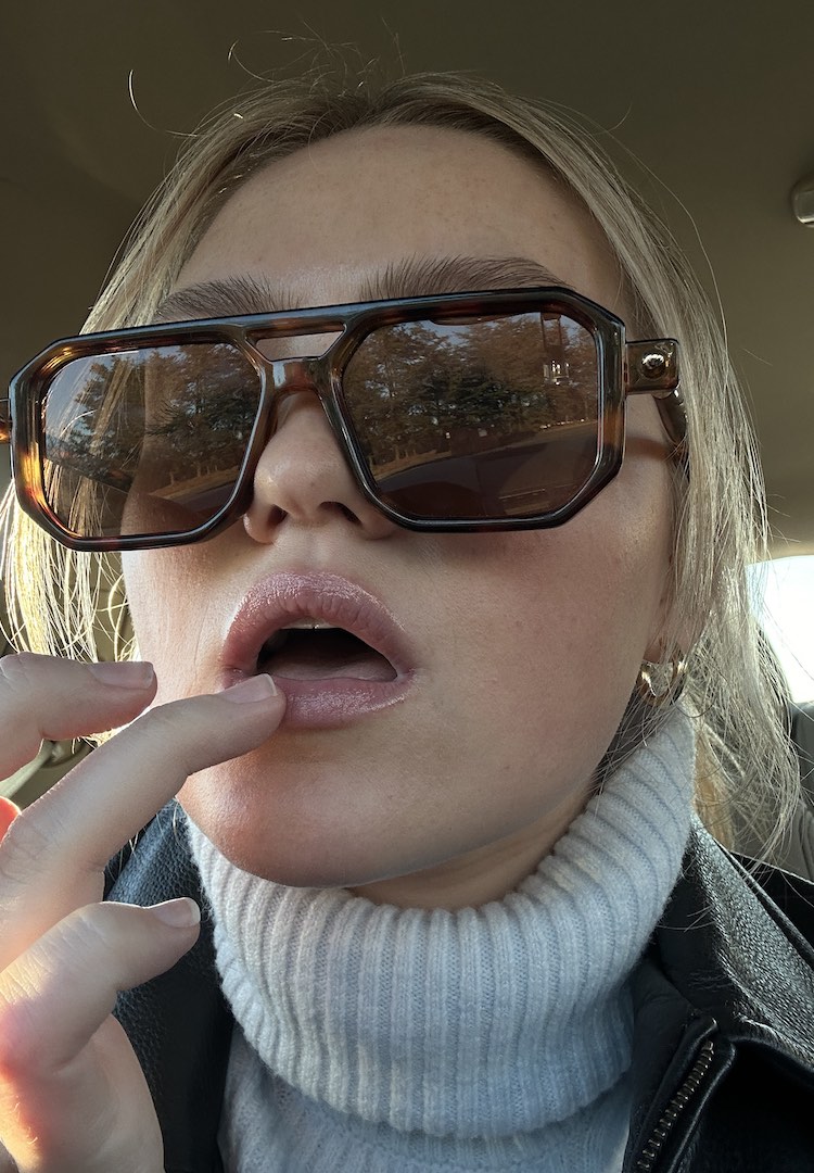 How to deal with a perioral dermatitis flareup