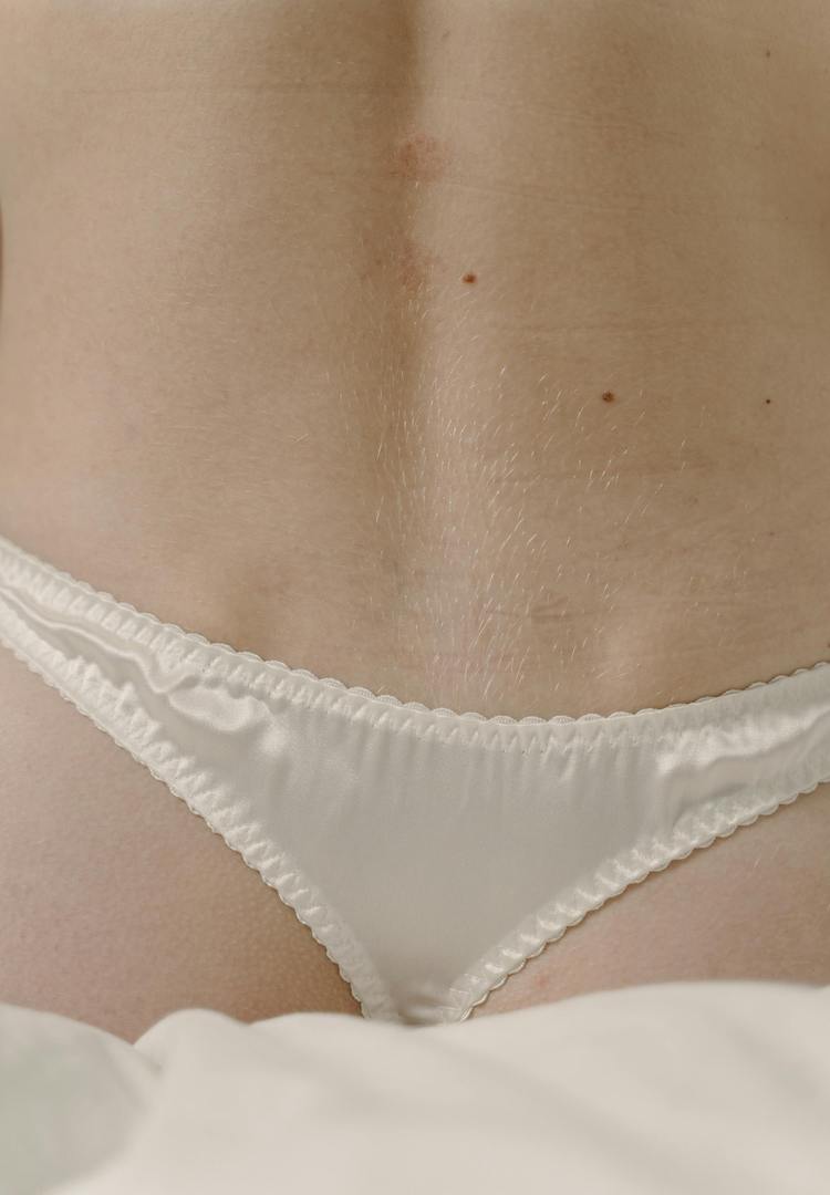 Can wearing g-strings cause yeast infections? I asked a gynaecologist