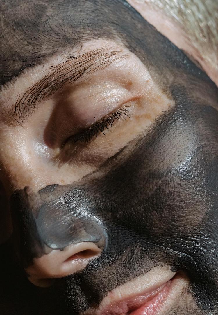 I tried a Carbon Laser facial to zap away my blackheads