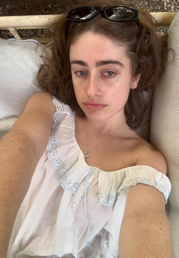 “You look tired”: What happened when I embraced my under-eye bags for a week