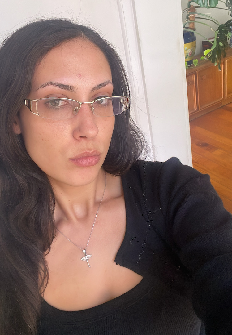 I tried Emface skin tightening for my dark under-eyes